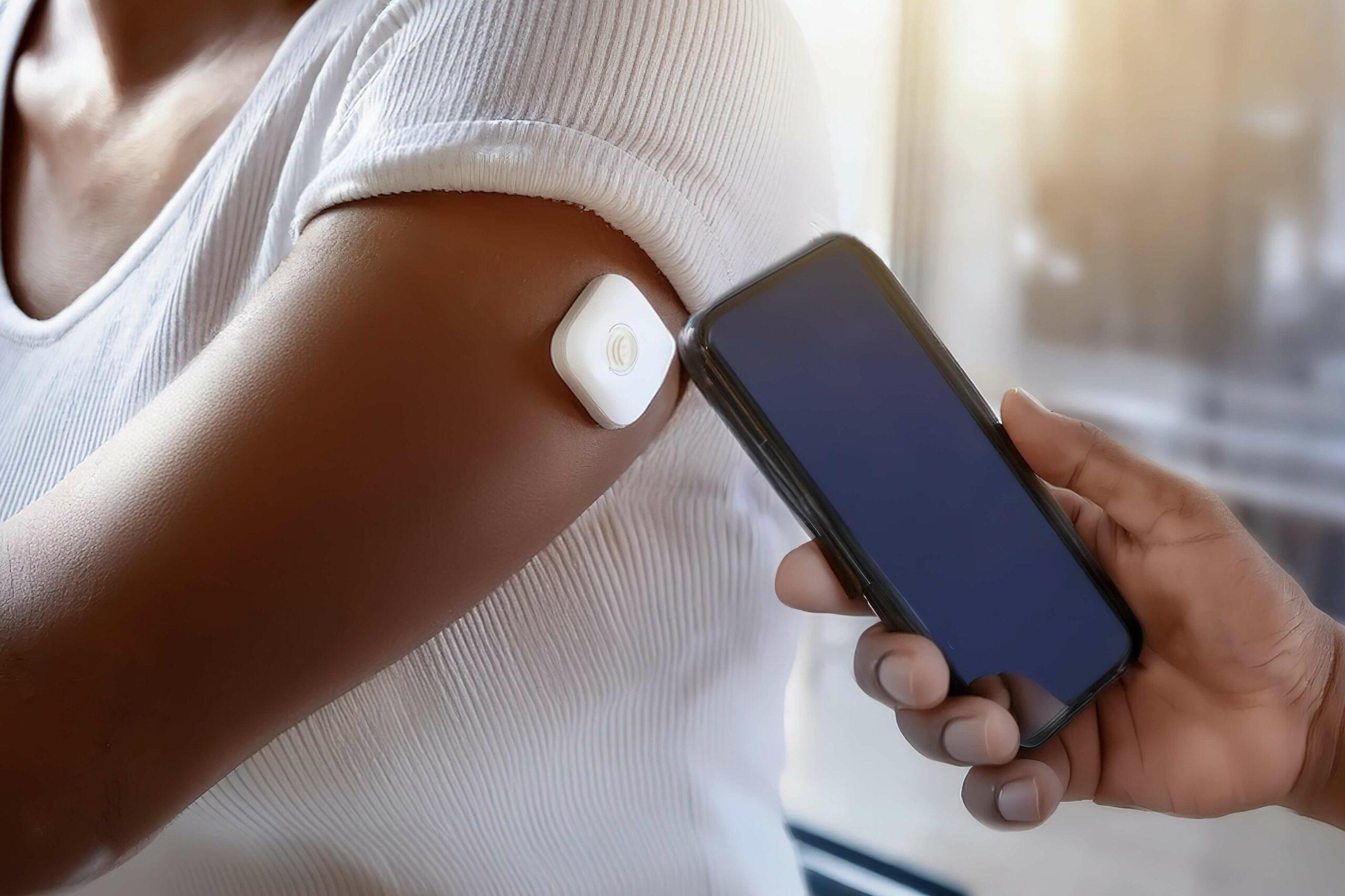 An den Arm einer dunkelhäutigen Person mit einem Blutzucker-Mess-Sensor wird ein Handy zum Auslesen gehalten.